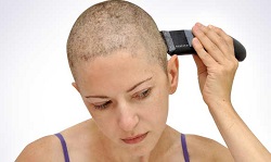 علت ریزش مو در شیمی درمانی چیست؟